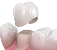 Braces